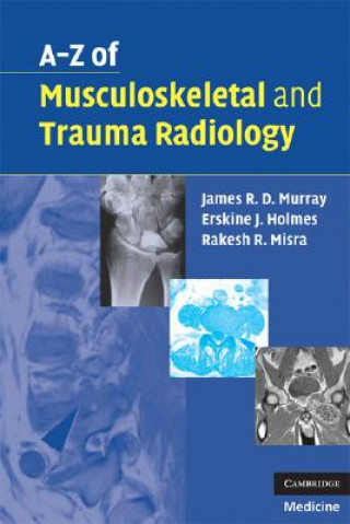 Könyv A-Z of Musculoskeletal and Trauma Radiology James Murray