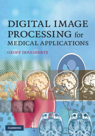 Könyv Digital Image Processing for Medical Applications Geoff Dougherty