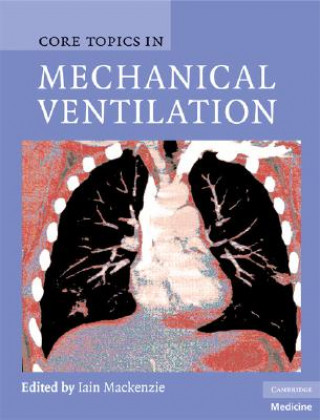 Kniha Core Topics in Mechanical Ventilation Iain Mackenzie