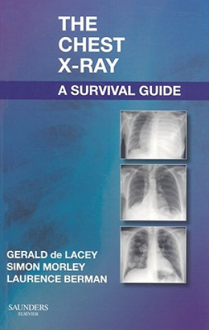 Book Chest X-Ray: A Survival Guide Gerald De Lacey