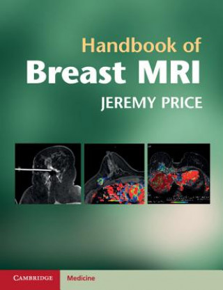 Książka Handbook of Breast MRI Jeremy Price