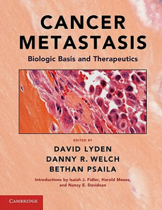 Könyv Cancer Metastasis David Lyden