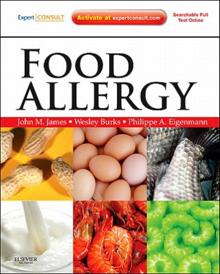 Kniha Food Allergy John M James