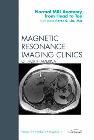 Книга Normal MR Anatomy from Head to Toe, An Issue of Magnetic Resonance Imaging Clinics Peter Liu