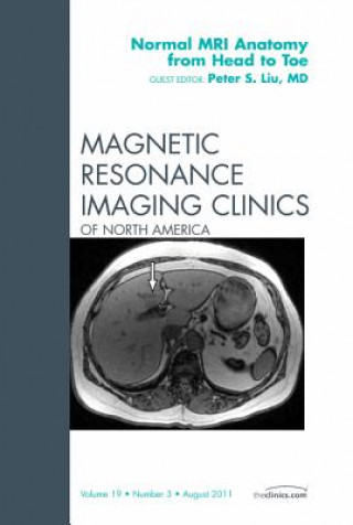 Kniha Normal MR Anatomy from Head to Toe, An Issue of Magnetic Resonance Imaging Clinics Peter Liu