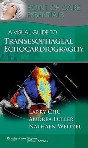 Boek Visual Guide to Transesophageal Echocardiography Larry Chu