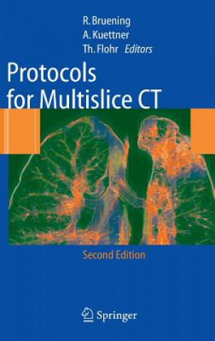 Kniha Protocols for Multislice CT Brüning