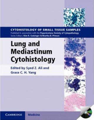 Kniha Lung and Mediastinum Cytohistology with CD-ROM Syed Ali