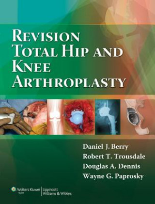 Könyv Revision Total Hip and Knee Arthroplasty Daniel Berry