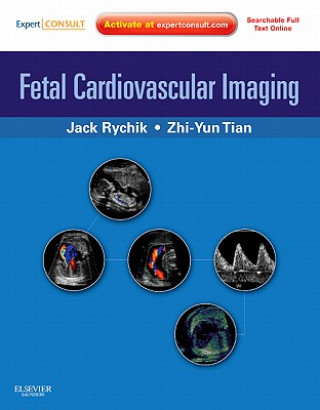 Kniha Fetal Cardiovascular Imaging: A Disease Based Approach Jack Rychik