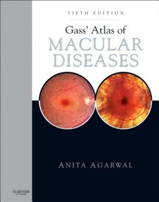 Kniha Gass' Atlas of Macular Diseases Anita Agarwal