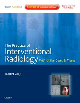 Carte Practice of Interventional Radiology, with online cases and video Karim Valji