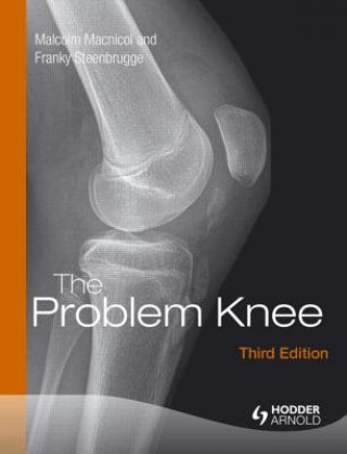 Könyv Problem Knee Malcolm Macnicol