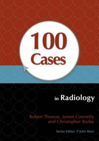 Carte 100 Cases in Radiology Robert Thomas