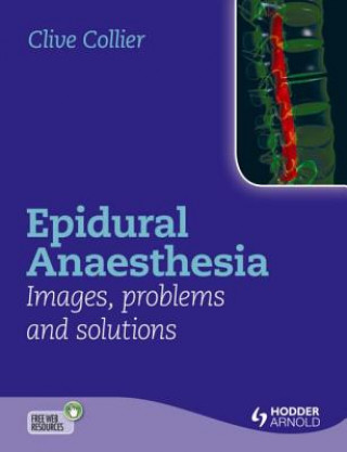 Kniha Epidural Anaesthesia: Images, Problems and Solutions Collier