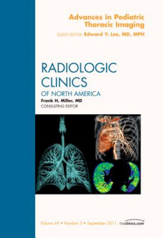 Carte Advances in Pediatric Thoracic Imaging, An Issue of Radiologic Clinics of North America Edward Lee