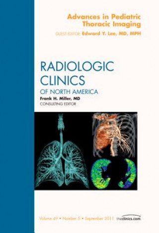 Kniha Advances in Pediatric Thoracic Imaging, An Issue of Radiologic Clinics of North America Edward Lee