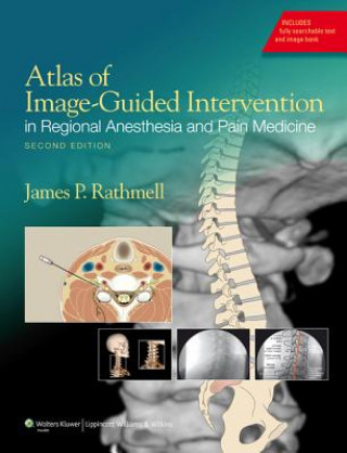 Kniha Atlas of Image-Guided Intervention in Regional Anesthesia and Pain Medicine James Rathmell