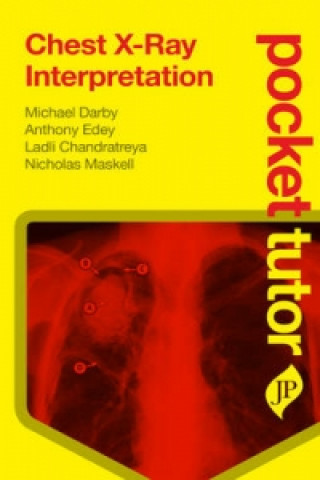 Kniha Pocket Tutor Chest X-Ray Interpretation Nicholas Maskell