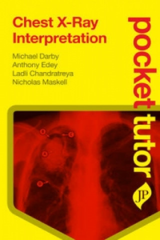 Book Pocket Tutor Chest X-Ray Interpretation Nicholas Maskell