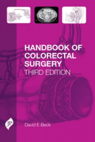 Carte Handbook of Colorectal Surgery David Beck