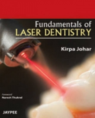 Buch Fundamentals of Laser Dentistry Kirpa Johar