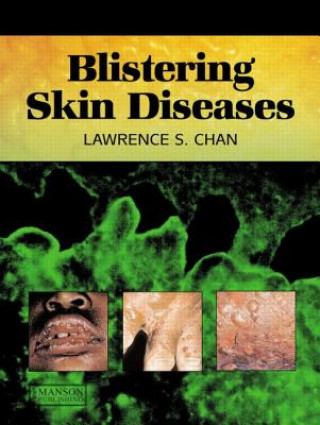 Kniha Blistering Skin Diseases Lawrence S Chan