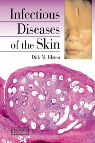 Kniha Infectious Diseases of the Skin Dirk M Elston