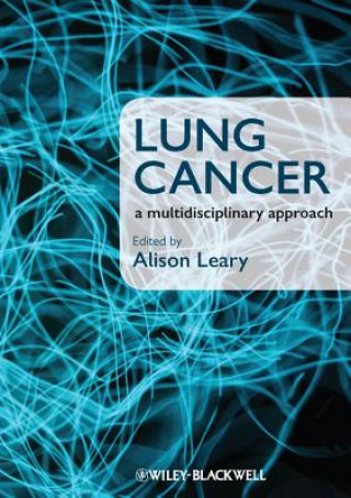 Carte Lung Cancer - A Multidisciplinary Approach Alison Leary