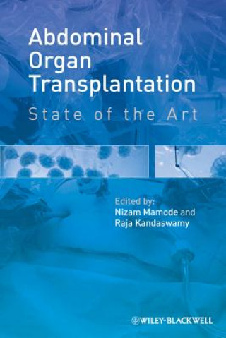 Carte Abdominal Organ Transplantation - State of the Art N Mamode