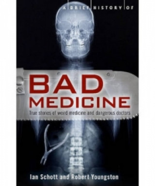 Knjiga Brief History of Bad Medicine Robert Youngston