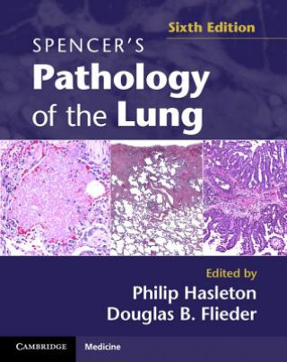 Carte Spencer's Pathology of the Lung 2 Part Set with DVDs Philip Hasleton