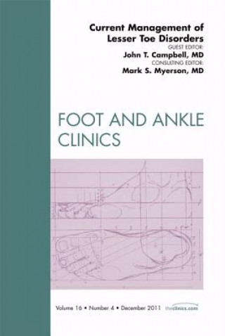 Carte Current Management of Lesser Toe Disorders, An Issue of Foot and Ankle Clinics John Campbell