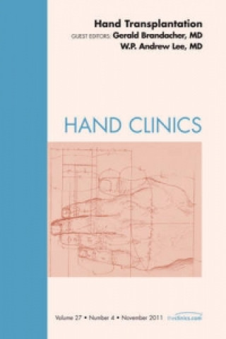 Livre Hand Transplantation, An Issue of Hand Clinics Gerald Brandacher