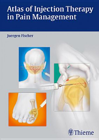 Kniha Atlas of Injection Therapy in Pain Management Jürgen Fischer