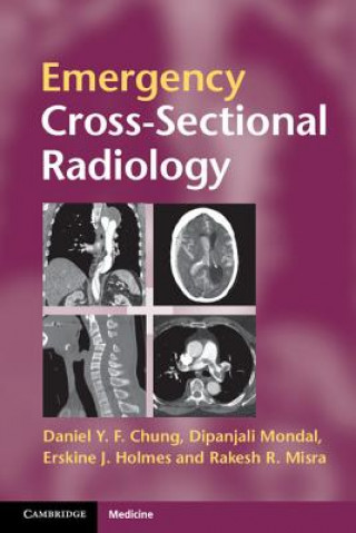 Knjiga Emergency Cross-sectional Radiology Daniel Y F Chung