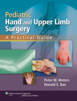 Knjiga Pediatric Hand and Upper Limb Surgery Peter M. Waters