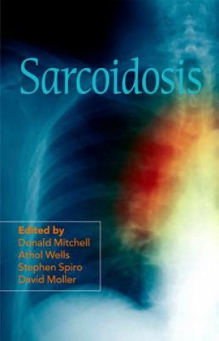 Kniha Sarcoidosis Donald Mitchell