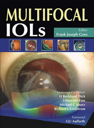 Knjiga Multifocal IOLs Frank Joseph Goes