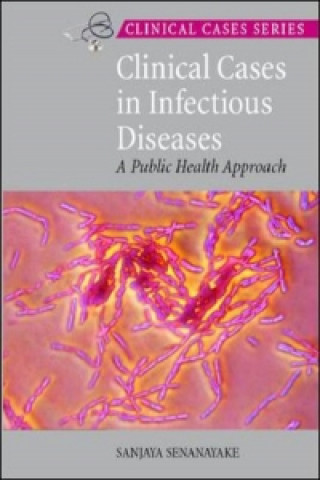 Könyv Clinical Cases in Infectious Diseases Sanjaya Senanayake