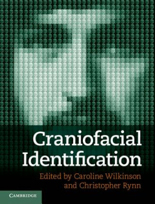 Carte Craniofacial Identification Christopher Wilkinson