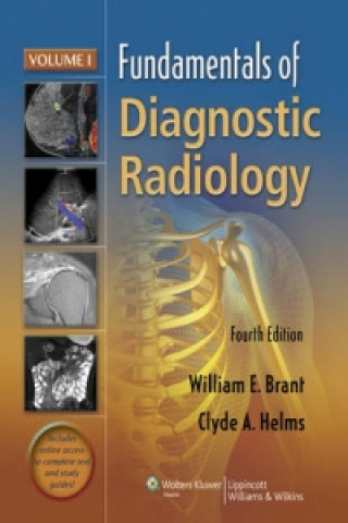 Carte Fundamentals of Diagnostic Radiology - 4 Volume Set William E Brant