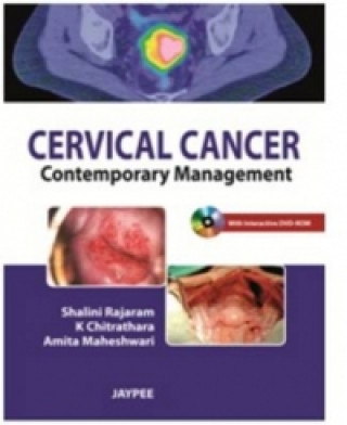 Book Cervical Cancer Shalinin Rajaram