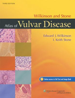 Carte Wilkinson and Stone Atlas of Vulvar Disease Edward Wilkinson