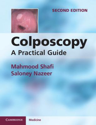 Kniha Colposcopy Mahmood Shafi