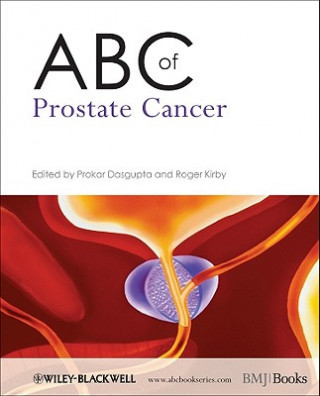 Książka ABC of Prostate Cancer Prokar Dasgupta