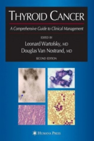 Livre Thyroid Cancer Leonard Wartofsky