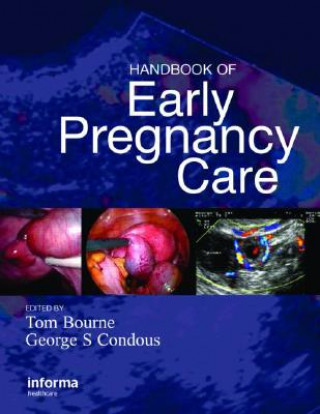 Carte Handbook of Early Pregnancy Care 