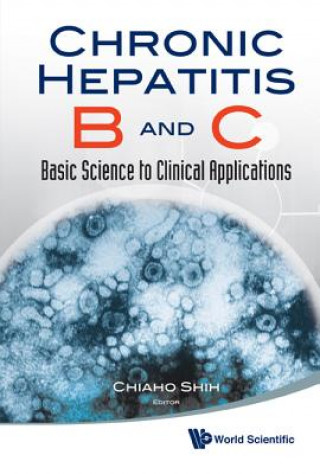 Kniha Chronic Hepatitis B And C: Basic Science To Clinical Applications Chiaho Shih