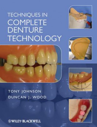 Kniha Techniques in Complete Denture Technology Tony Johnson